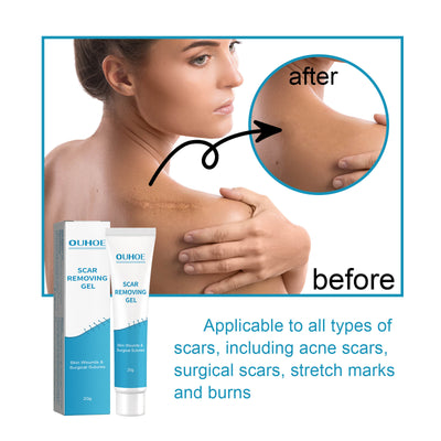 Softening And Smoothing Scars Smooth Moisturizing Fade Skin Blemishes Care Gel