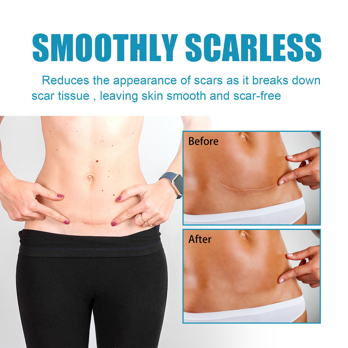 Softening And Smoothing Scars Smooth Moisturizing Fade Skin Blemishes Care Gel