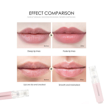 Lip Care Yifeng Lip High Frequency Vibration Lip Massager